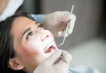 Benefits Of Invisalign Dental Treatment